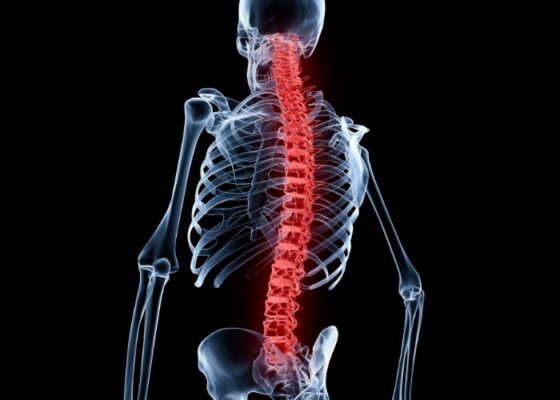 tratamiento y cirugia de columna en puebla